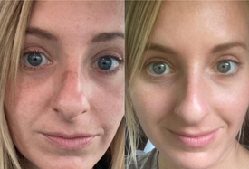 PDRN Collagen Multi Balm