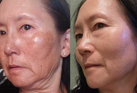 PDRN Collagen Multi Balm