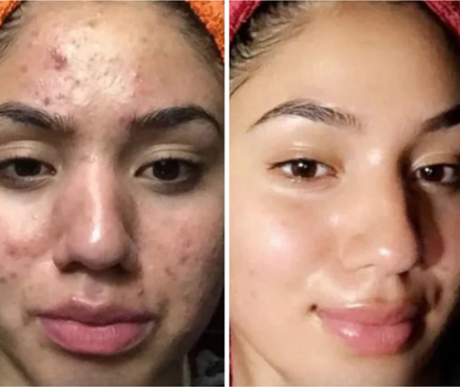PDRN Collagen Multi Balm
