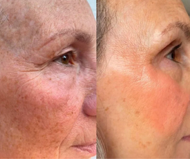 PDRN Collagen Multi Balm