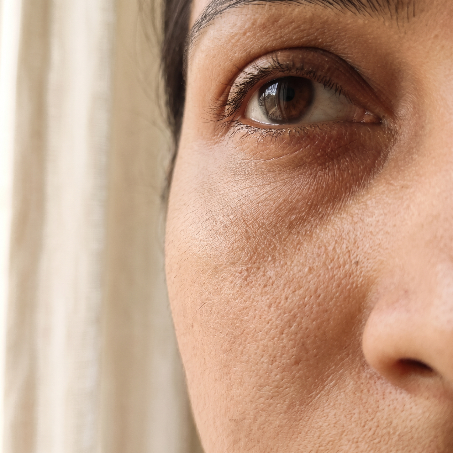 Under-eye pigmentation close-up